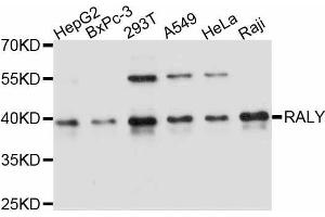 Western blot analysis of extracts of various cell lines, using RALY antibody. (Raly antibody  (AA 96-306))
