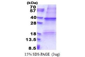 SDS-PAGE (SDS) image for Colony Stimulating Factor 2 Receptor, Alpha, Low-Affinity (Granulocyte-Macrophage) (CSF2RA) (AA 20-320) protein (His tag) (ABIN5853286)