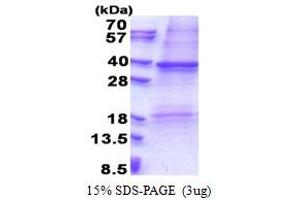 SDS-PAGE (SDS) image for Colony Stimulating Factor 2 Receptor, Alpha, Low-Affinity (Granulocyte-Macrophage) (CSF2RA) (AA 20-320) protein (His tag) (ABIN5853286) (CSF2RA Protein (AA 20-320) (His tag))