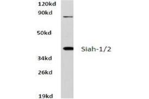 Western blot analysis of Siah-1/2 Antibody  in extracts from HeLa cells at 1/500 dilution.