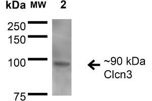 Western Blot analysis of Rat Brain Membrane showing detection of ~90 kDa CIcn3 protein using Mouse Anti-CIcn3 Monoclonal Antibody, Clone S258-5 . (CLCN3 antibody  (AA 98-115) (Atto 594))