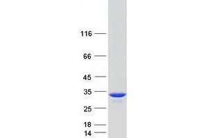 Validation with Western Blot (TPI1 Protein (Myc-DYKDDDDK Tag))