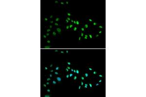 Immunofluorescence analysis of A549 cell using DNMT3A antibody. (DNMT3A antibody)