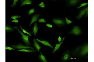 Immunofluorescence of monoclonal antibody to PURA on HeLa cell. (PURA antibody  (AA 183-292))