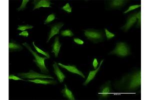 Immunofluorescence of monoclonal antibody to PURA on HeLa cell.