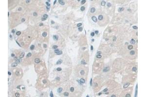 DAB staining on IHC-P; Samples: Human Stomach Tissue (Ancient Ubiquitous Protein 1 antibody  (AA 201-410))