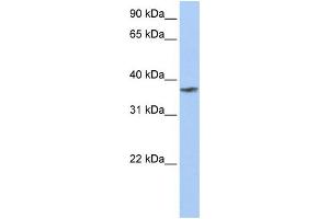 WB Suggested Anti-TMCC1 Antibody Titration:  0. (TMCC1 antibody  (C-Term))