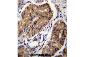 Immunohistochemistry (IHC) image for anti-Deleted in Colorectal Carcinoma (DCC) antibody (ABIN2996670)