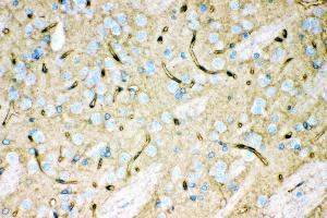 Anti- Aquaporin 4 Picoband antibody, IHC(P) IHC(P): Rat Brain Tissue (Aquaporin 4 antibody  (C-Term))