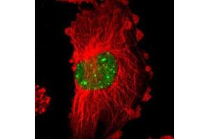 Immunofluorescent staining of U-251 MG with MYST4 polyclonal antibody  (Green) shows positivity in nucleus.