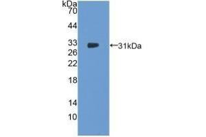 Detection of Recombinant NOSTRIN, Human using Polyclonal Antibody to Nitric Oxide Synthase Trafficker (NOSTRIN) (NOSTRIN antibody  (AA 18-251))