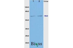 SDS-PAGE (SDS) image for anti-Bone Morphogenetic Protein Receptor 1A (BMPR1A) (AA 101-200) antibody (ABIN687547)