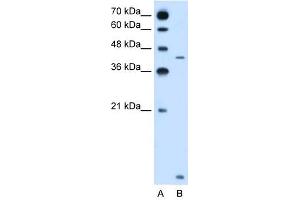 SLC46A3 antibody used at 2. (SLC46A3 antibody  (N-Term))
