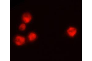 Wdpks1Δ-1 yeast cells treated with liquid nitrogen were stained with anti-melanin followed by Goat Anti-Mouse IgM, Human ads-TRITC (Goat anti-Mouse IgM (Heavy Chain) Antibody (TRITC))