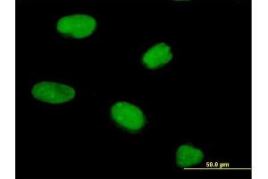Immunofluorescence of purified MaxPab antibody to PRR6 on HeLa cell. (CENPV antibody  (AA 1-275))