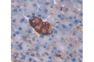 Figure. (LGALS9C antibody  (AA 228-356))