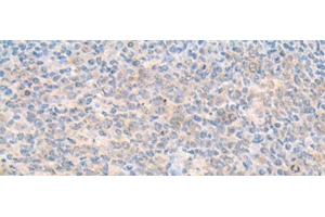 Immunohistochemistry of paraffin-embedded Human tonsil tissue using SMS Polyclonal Antibody at dilution of 1:70(x200) (SMS antibody)