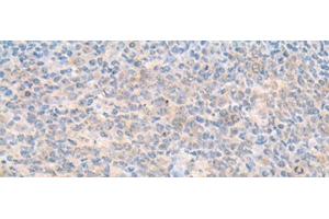 Immunohistochemistry of paraffin-embedded Human tonsil tissue using SMS Polyclonal Antibody at dilution of 1:70(x200)