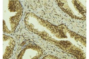 Immunohistochemistry (IHC) image for anti-Mediator Complex Subunit 1 (MED1) (C-Term) antibody (ABIN6257759)