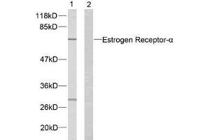 Western blot analysis of extracts from MCF7 cells using Estrogen Receptor-α (Ab-167) antibody (E021068). (Estrogen Receptor alpha antibody)