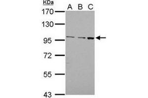 AP31133PU-N EMR1 antibody staining of Jurkat (Lane A), Raji (Lane B) and K562 (Lane C)whole cell lysates (30 µg) at 1/1000 dilution, 7. (F4/80 antibody  (AA 626-886))