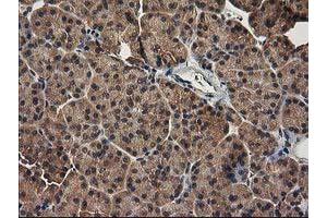 Image no. 2 for anti-Tubulin Folding Cofactor E-Like (TBCEL) antibody (ABIN1501326) (TBCEL antibody)