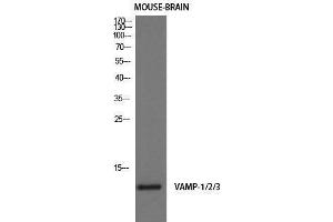 Western Blotting (WB) image for anti-Vamp-1+2+3 (Internal Region) antibody (ABIN3177900) (Vamp-1+2+3 (Internal Region) antibody)