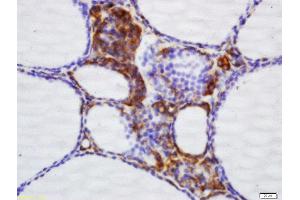 Formalin-fixed and paraffin embedded dog thyroid labeled with Rabbit Anti-NNT Polyclonal Antibody, Unconjugated (ABIN709631) at 1:200 followed by conjugation to the secondary antibody and DAB staining (NNT antibody  (AA 981-1086))