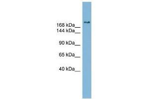 SETBP1 antibody used at 0. (SETBP1 antibody  (Middle Region))
