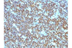 IHC testing of CD20 antibody and FFPE human tonsil tissue. (CD20 (B Cells) antibody)