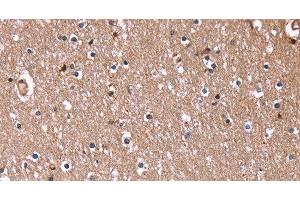 Immunohistochemistry of paraffin-embedded Human brain using RDX Polyclonal Antibody at dilution of 1:60 (Radixin antibody)
