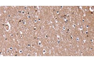 Immunohistochemistry of paraffin-embedded Human brain using RDX Polyclonal Antibody at dilution of 1:60