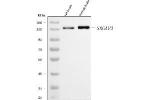 Western blot analysis of SRGAP3 using anti-SRGAP3 antibody (ABIN7602538). (SRGAP3 antibody  (AA 824-1067))