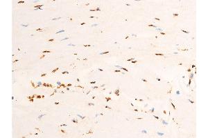Immunohistochemistry (IHC) image for anti-Jun Proto-Oncogene (JUN) (pThr91) antibody (ABIN6256604)