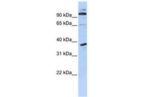 Image no. 1 for anti-PHD Finger Protein 11 (PHF11) (N-Term) antibody (ABIN6740584) (PHF11 antibody  (N-Term))