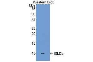 Western Blotting (WB) image for anti-Heparanase (HPSE) (AA 27-101) antibody (ABIN1173468) (HPSE antibody  (AA 27-101))