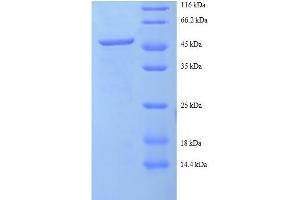 Charged Multivesicular Body Protein 2A (CHMP2A) (AA 1-222), (full length) protein (GST tag) (CHMP2A Protein (AA 1-222, full length) (GST tag))