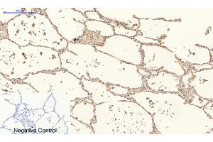 Immunohistochemical analysis of paraffin-embedded human lung tissue. (Collagen IV antibody)