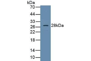 Detection of Recombinant SOCS1, Human using Polyclonal Antibody to Suppressors Of Cytokine Signaling 1 (SOCS1) (SOCS1 antibody  (AA 1-211))