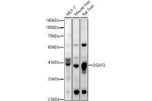 Western blot analysis of extracts of various cell lines, using DG antibody (ABIN6130268, ABIN6139559, ABIN6139561 and ABIN6218054) at 1:1000 dilution. (DGAT2 antibody  (AA 113-388))