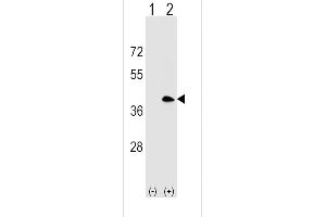 Western blot analysis of MS4A1 (arrow) using rabbit polyclonal MS4A1 Antibody (C-term) (ABIN1536862 and ABIN2848628). (CD20 antibody  (C-Term))