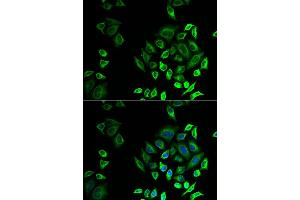 Immunofluorescence analysis of U2OS cell using PLA2G2D antibody.