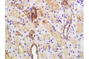Immunohistochemistry (IHC) image for anti-Plakophilin 2 (PKP2) (AA 801-881) antibody (ABIN1386389)