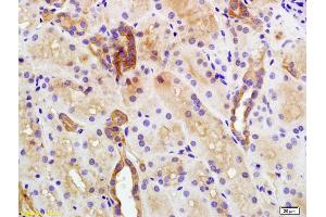 Formalin-fixed and paraffin embedded human kidney labeled with Anti-Plakophilin 2 Polyclonal Antibody, Unconjugated (ABIN1386389) at 1:200 followed by conjugation to the secondary antibody and DAB staining (Plakophilin 2 antibody  (AA 801-881))