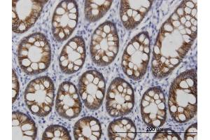 Immunoperoxidase of monoclonal antibody to CDH17 on formalin-fixed paraffin-embedded human colon. (LI Cadherin antibody  (AA 24-131))