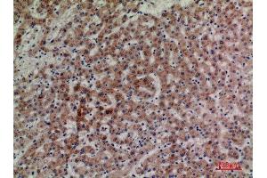 Immunohistochemistry (IHC) analysis of paraffin-embedded Human Liver, antibody was diluted at 1:100. (LILRA4 antibody  (Internal Region))