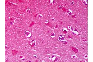 Anti-GRIN2B / NMDAR2B antibody IHC of human brain, cortex neurons. (GRIN2B antibody  (AA 20-271))