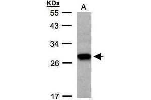WB Image Sample(30 ug whole cell lysate) A: H1299 12% SDS PAGE antibody diluted at 1:500