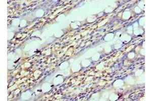 Immunohistochemistry of paraffin-embedded human colon tissue using ABIN7161635 at dilution of 1:100 (NPRL2 antibody  (AA 1-220))