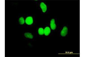Immunofluorescence of purified MaxPab antibody to HELLS on HeLa cell. (HELLS antibody  (AA 1-838))